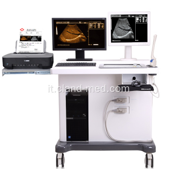 Macchina di ultrasuono medica carrello 3D con workstation